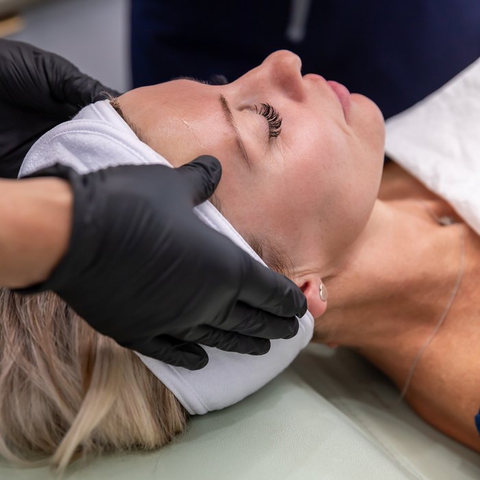 Pigmentation and sun damage treatment in Melton