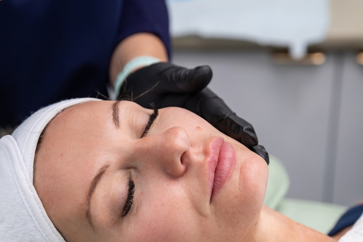 Perimenopausal skin treatment in Melton